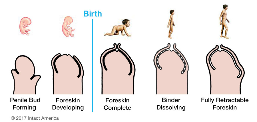 Normal development of the foreskin from womb to adulthood - by Dan Bollinger